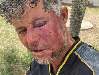 Homem é agredido brutalmente em sua casa na Chapadinha, em Elísio Medrado